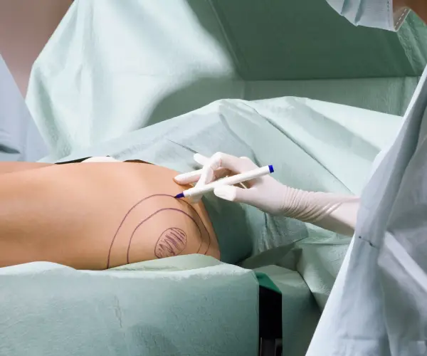 عوارض لیپوماتیک عوارض لیپوماتیک