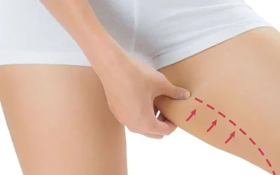 لیپوماتیک ران، مزایا و عوارض