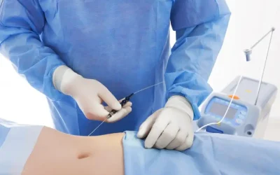 مزایای لیپوماتیک – عوارض لیپوماتیک