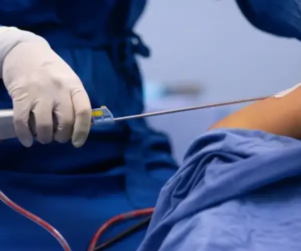 وزن مناسب برای لیپوماتیک چقدر است؟ وزن مناسب برای لیپوماتیک چقدر است؟