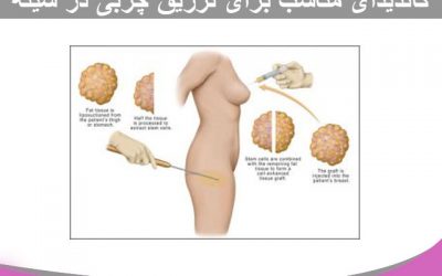 کاندیدای مناسب برای تزریق چربی در سینه
