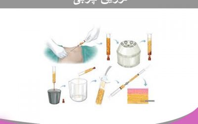 تزریق چربی