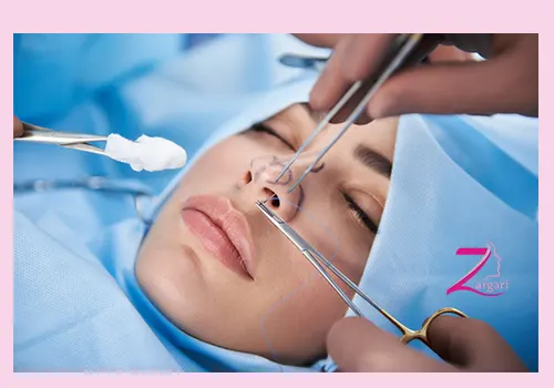 کوچک کردن پره های بینی