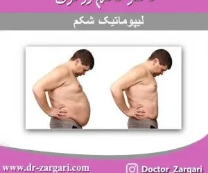 لیپوماتیک شکم + فیلم جراحی شکم با لیپوماتیک