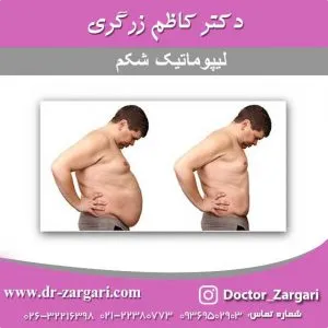 لیپوماتیک-شکم لیپوماتیک شکم