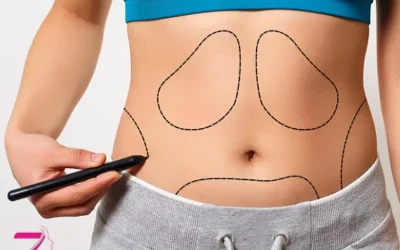 لیپوماتیک بهتر است یا لیپولیز ؟