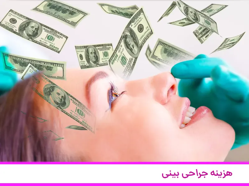 هزینه جراحی بینی