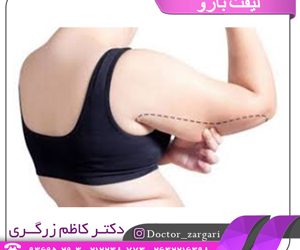 جراحی لیفت بازو