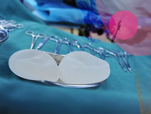 پروتز سینه در اتاق عمل