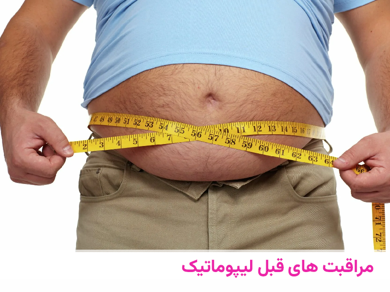 مراقبت های قبل لیپوماتیک