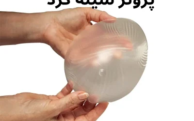 پروتز سینه مدل گرد