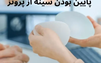 پايين بودن سينه از پروتز بعد از عمل پروتز