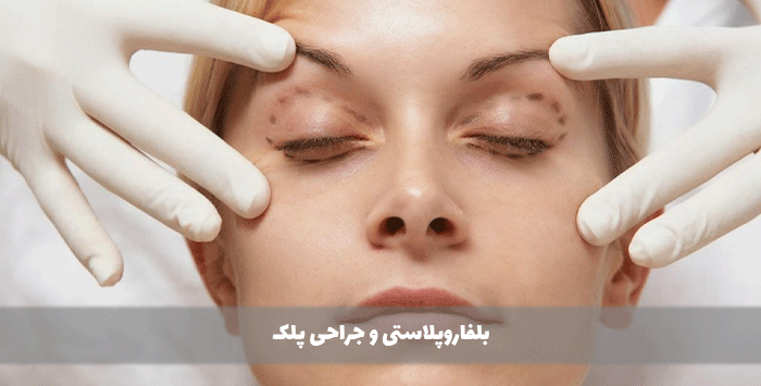 جراحی پلک