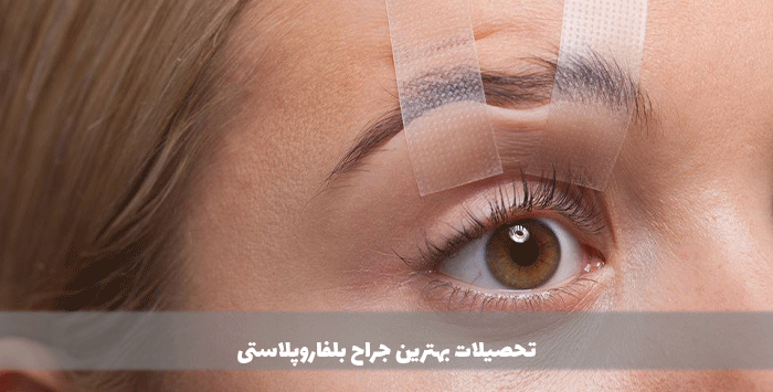 تحصیلات بهترین جراح بلفاروپلاستی