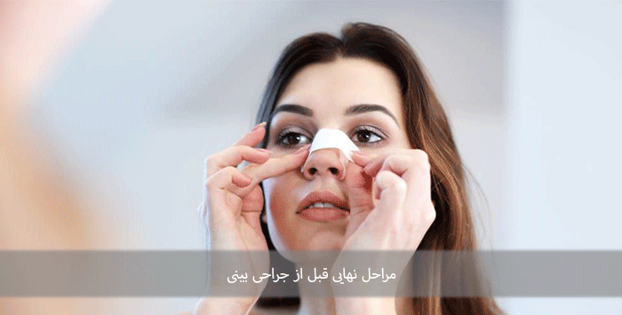 مراحل نهایی قبل از جراحی بینی