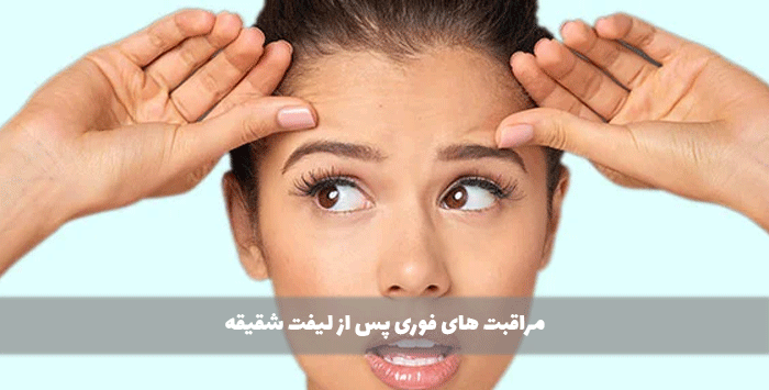 مراقبت های فوری پس از لیفت شقیقه