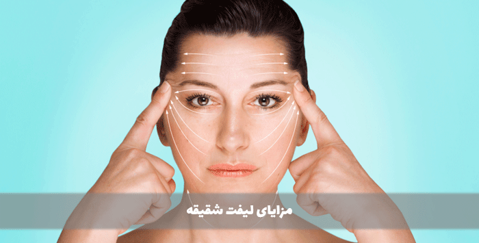 مزایای لیفت شقیقه