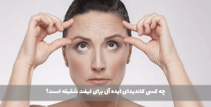 چه کسی کاندیدای ایده آل برای لیفت شقیقه است؟