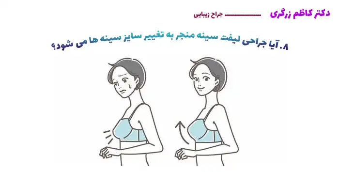 8. آیا جراحی لیفت سینه منجر به تغییر سایز سینه ها می شود؟