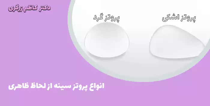انواع پروتز سینه از لحاظ ظاهری