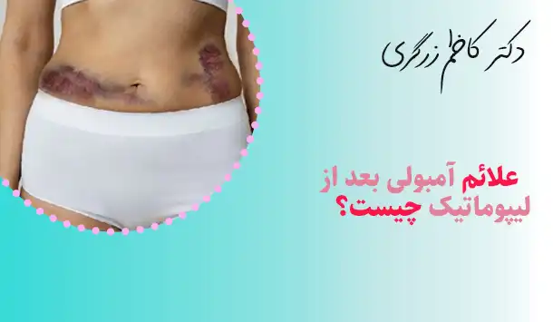 علائم آمبولی بعد از لیپوماتیک چیست؟