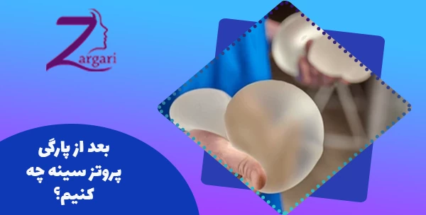 بعد از پارگی پروتز سینه چه کنیم؟