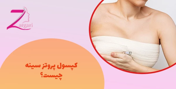 کپسول پروتز سینه چیست؟