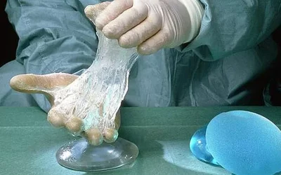 چه زمانی نیاز به تعویض پروتز سینه است؟