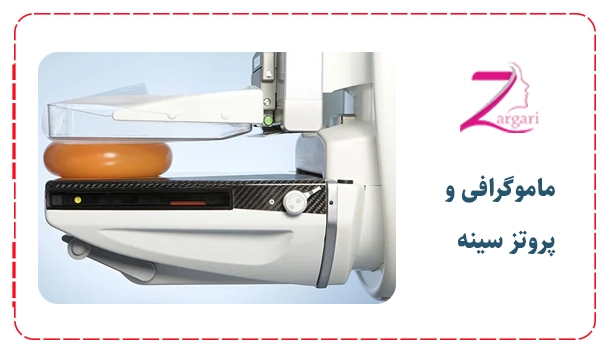 ماموگرافی و پروتز سینه