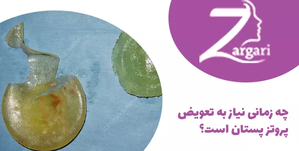 چه زمانی نیاز به تعویض پروتز پستان است؟
