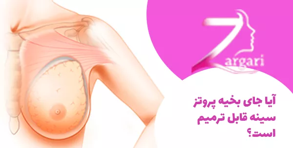 آیا جای بخیه پروتز سینه قابل ترمیم است؟