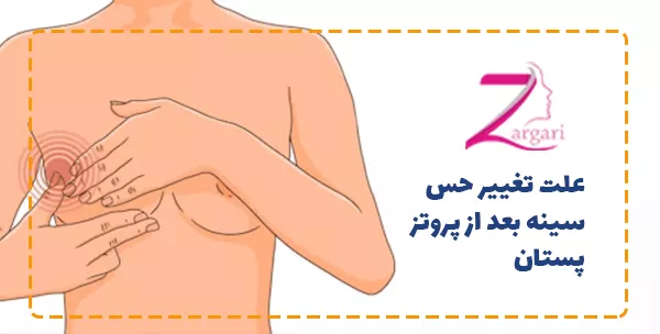 علت تغییر حس سینه بعد از پروتز پستان