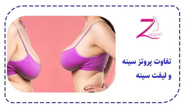 تفاوت پروتز سینه و لیفت سینه از لحاظ تعریف