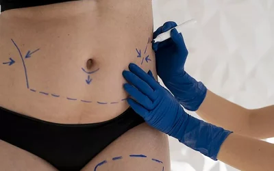 عوارض و خطرات جراحی لیپوماتیک