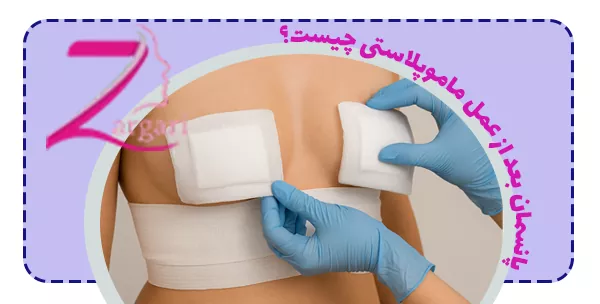 پانسمان بعد از عمل ماموپلاستی چیست؟