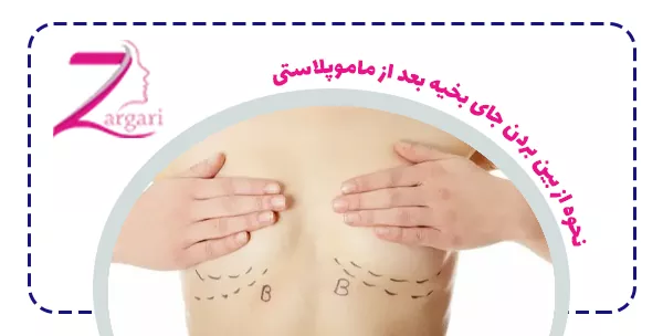 نحوه از بین بردن جای بخیه بعد از ماموپلاستی