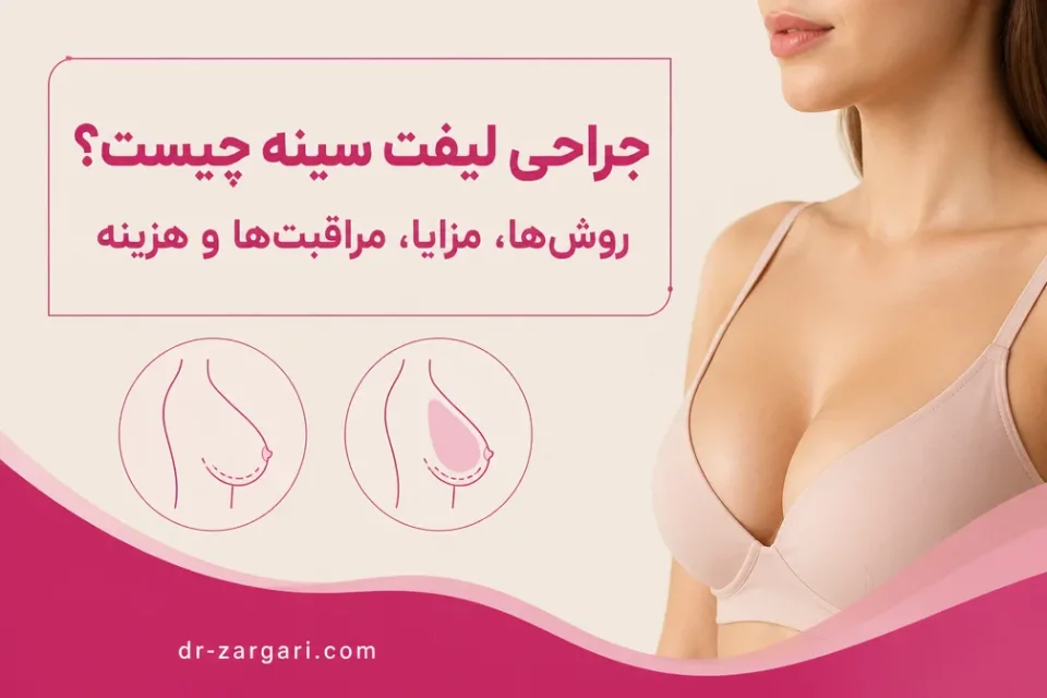 نمای توضیحی درباره لیفت سینه بدون پروتز یا همراه با پروتز؛ کدام مناسبتر است