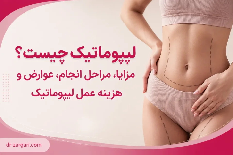 نمای توضیحی درباره چه کسانی نباید لیپوماتیک انجام دهند
