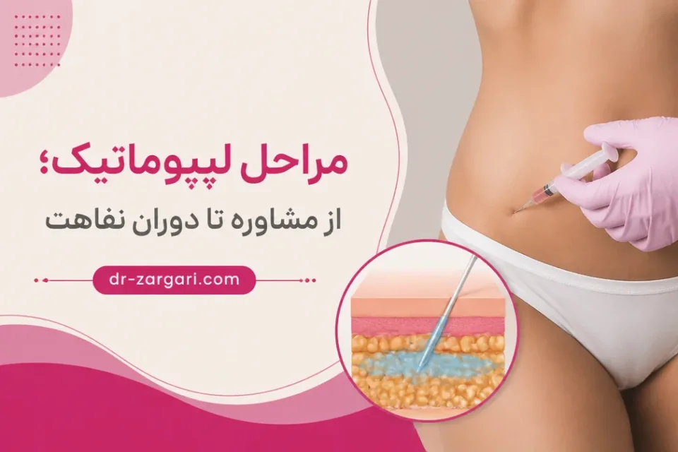 نمای توضیحی درباره ۵. تزریق محلول مخصوص