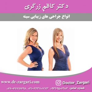 جراحی زیبایی سینه