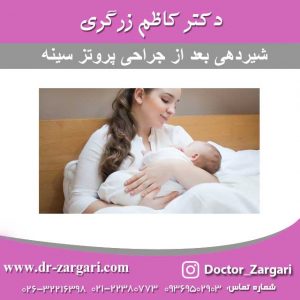 شیردهی بعد از عمل پروتز سینه