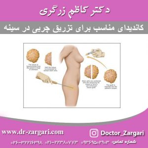 کاندیدای مناسب برای تزریق چربی در سینه
